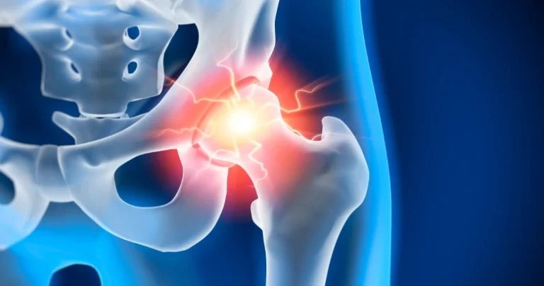 The ‘Young’ Hip Patient: When to Preserve vs. When to Replace